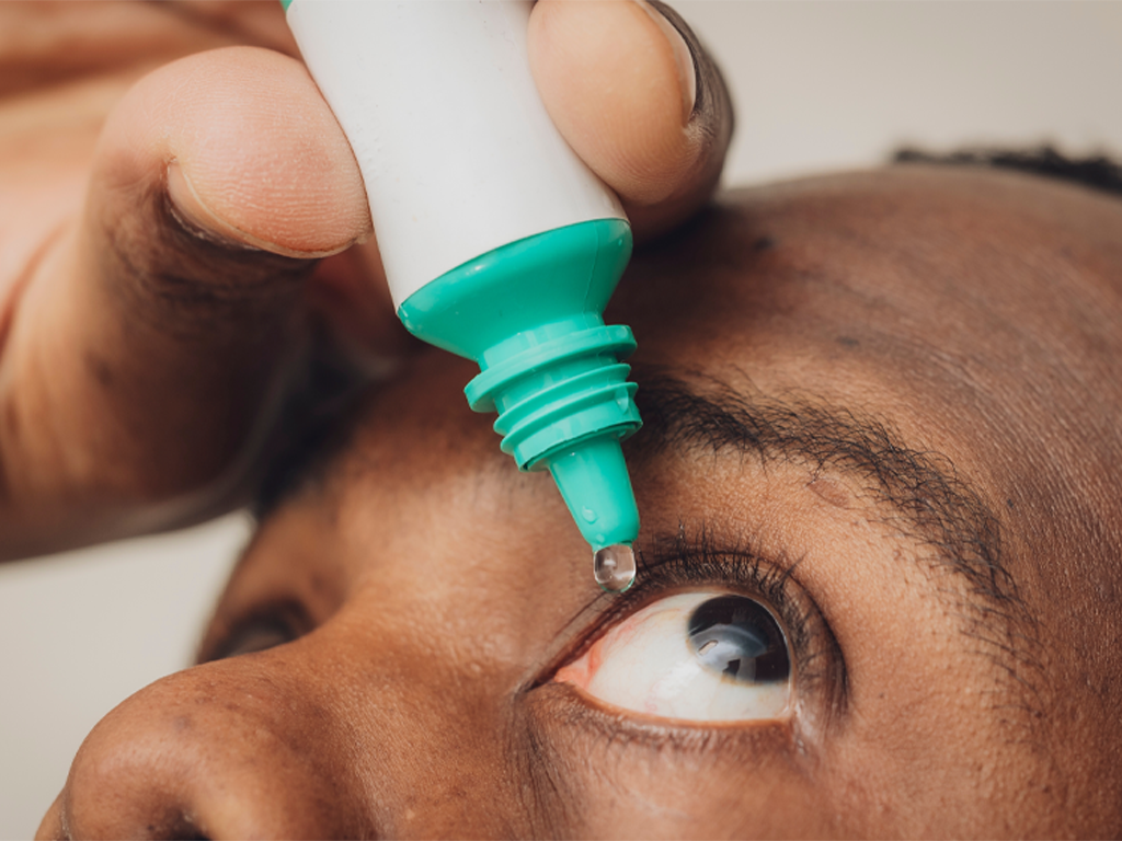 Person applying eye drops to eye. 